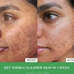 Daily D-Clog Pore-Clearing Cleanser