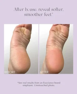 Exfoliating & Conditioning Foot Balm