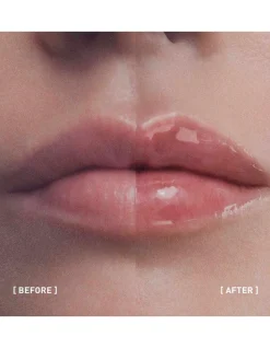 Filorga Hyalu-Filler Lips 4g