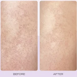 KP Body Scrub Strawberry - Bodyscrub med AHA Jordbærduft Omgående virk