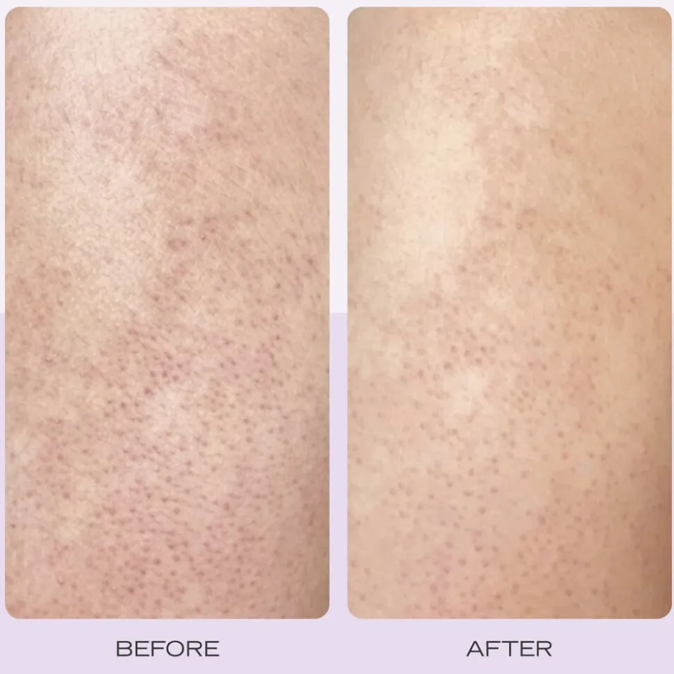 KP Body Scrub Strawberry - Bodyscrub med AHA Jordbærduft Omgående virk