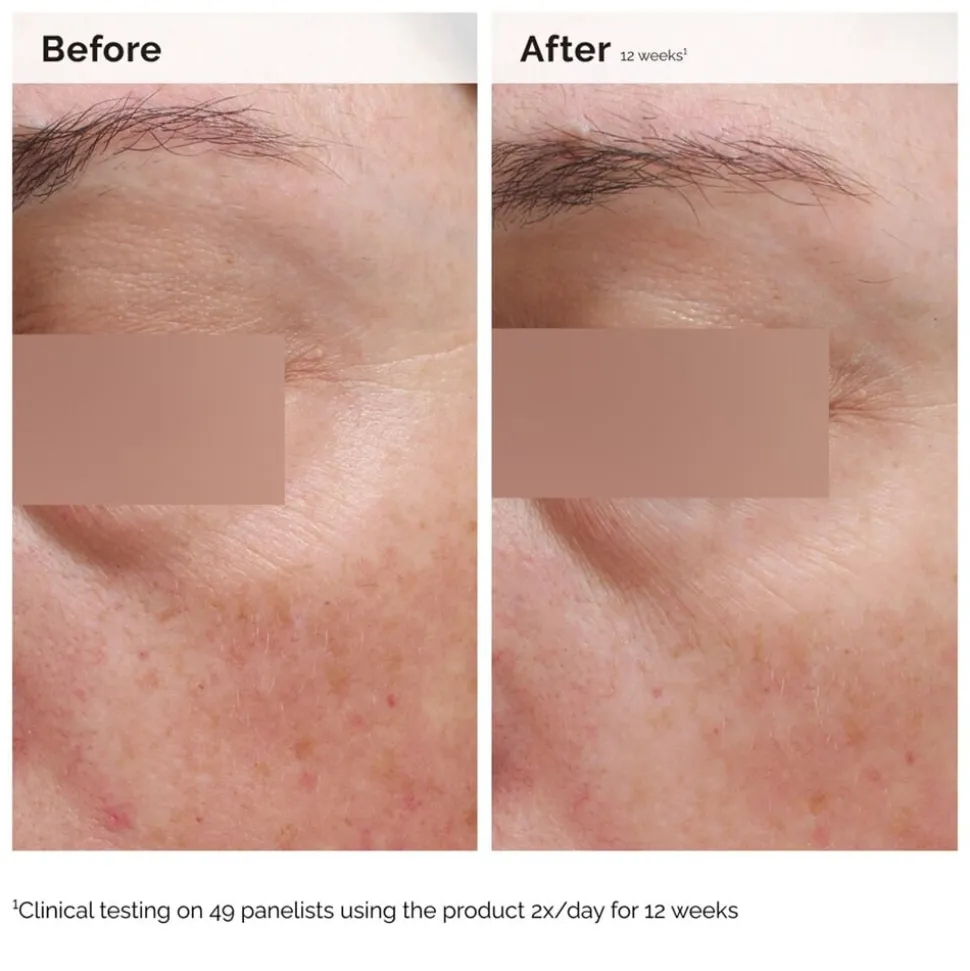 Niacinamide 5% Face and Body Emulsion