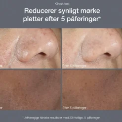 Powerbright Dark Spot Peel 50ml
