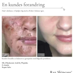 Raz Skincare Repair Salve Perfume Free 15 ml