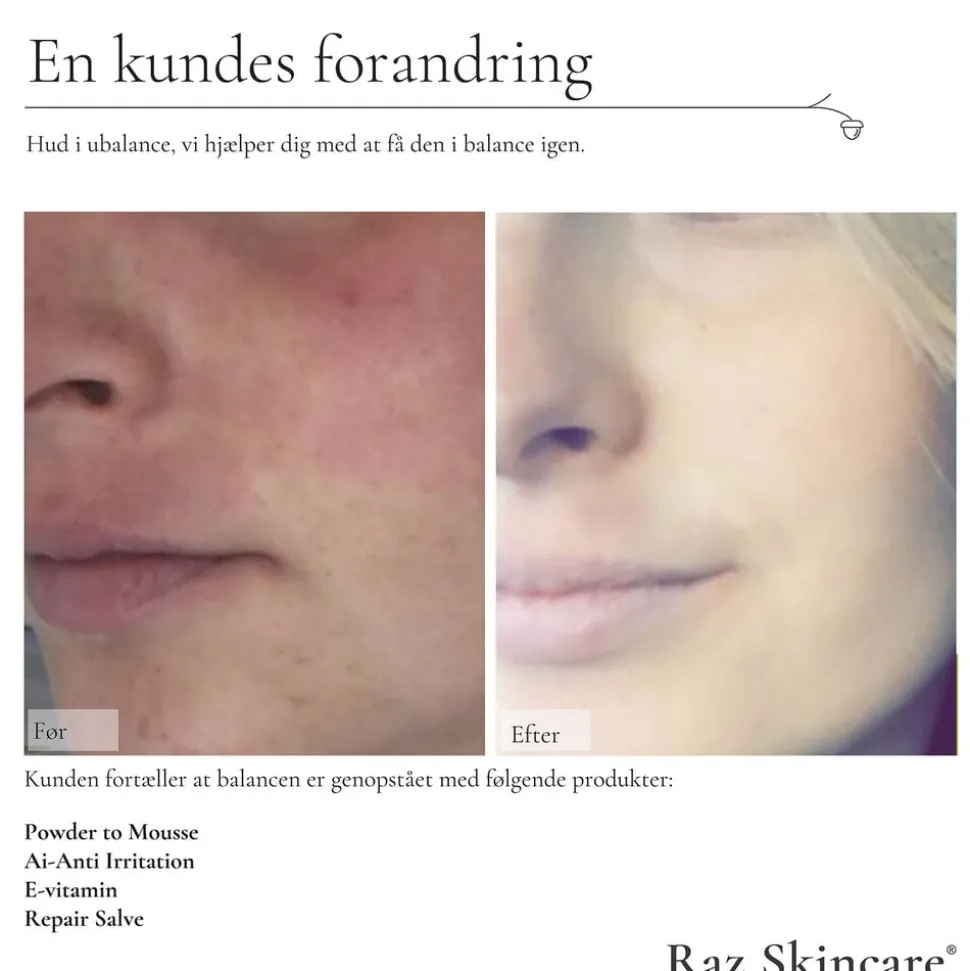 Raz Skincare Repair Salve 15 ml