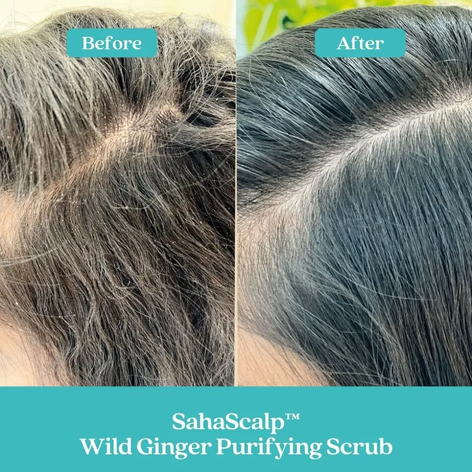 SAHASCALP SCALP RESET KIT