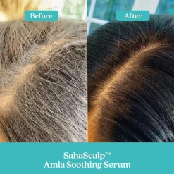 SAHASCALP SCALP RESET KIT