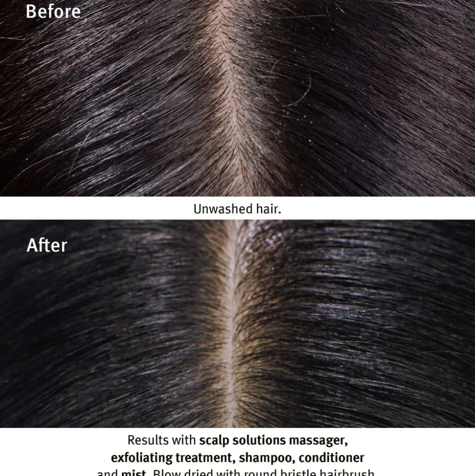 Scalp Solutions Stimulating Scalp Massager