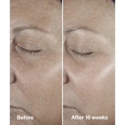 Smart Clinical Repair Wrinkle Correcting Serum