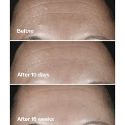 Smart Clinical Repair Wrinkle Correcting Serum