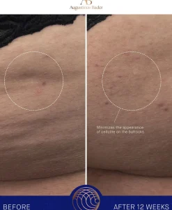 The Body Cream