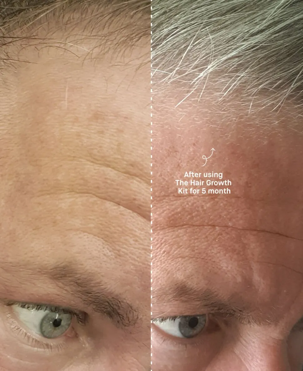 The Hair Growth Kit